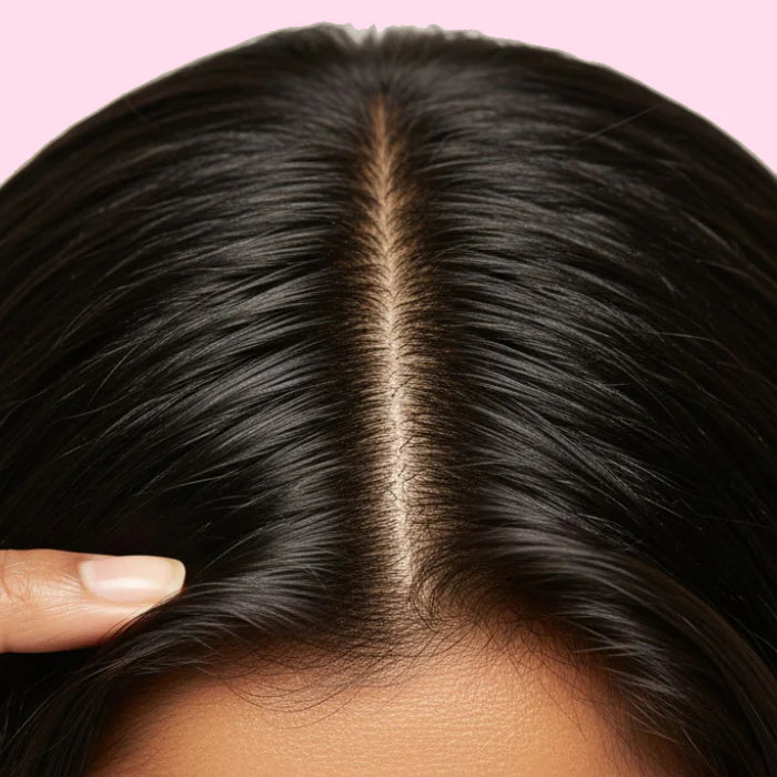 Oily Hair